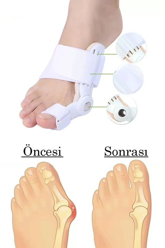 Ayak Başparmak Düzeltici Kemik Çıkığı Düzleştirici Taraklı Ayaklar Için Atel